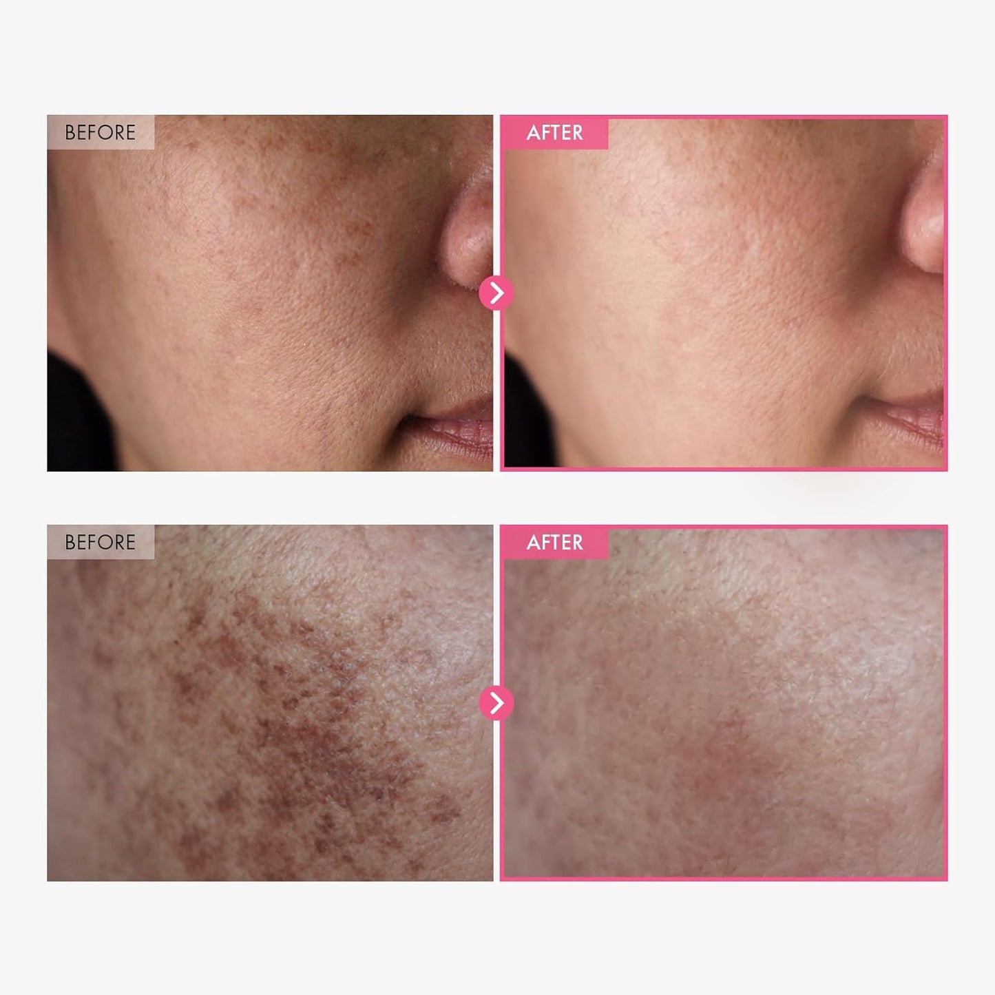 Ultra-Brightening Arbutin & Tranexamic Acid Glow Cream
