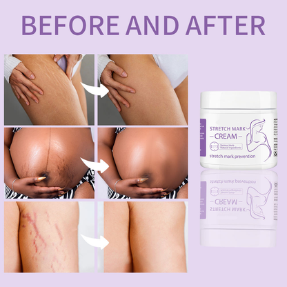 Creme Intensivo Reparador de Estrias
