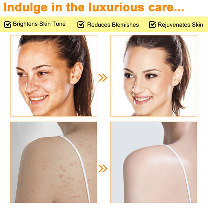 Lemon Turmeric & Kojic Acid Brightening Cleansing Bar