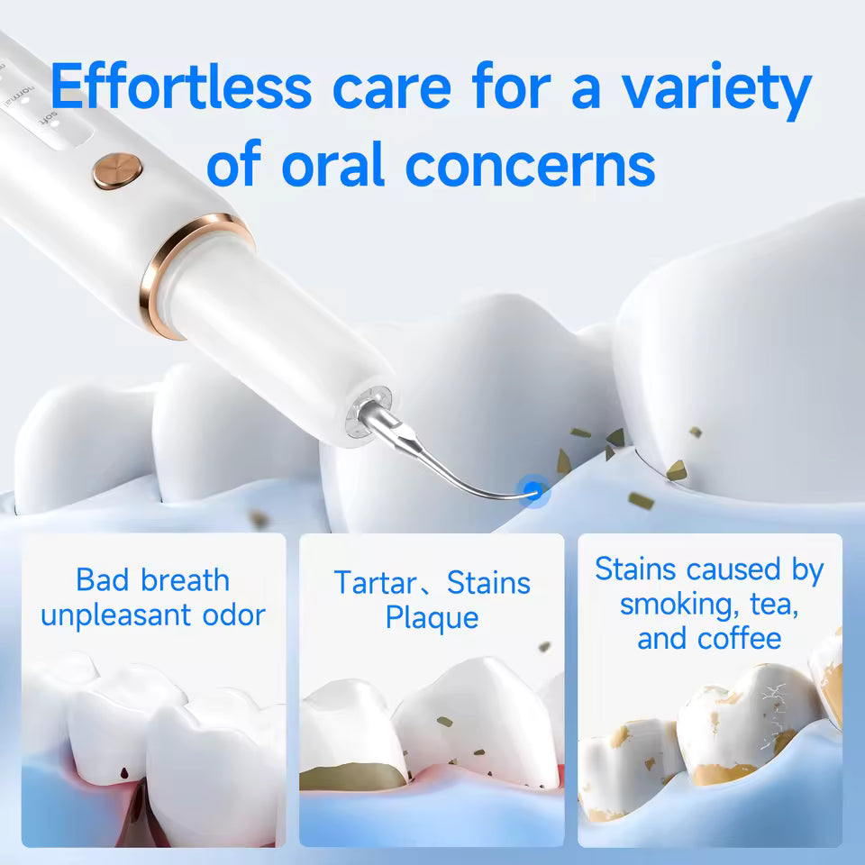 Limpeza Dentária Ultrassónica Profissional