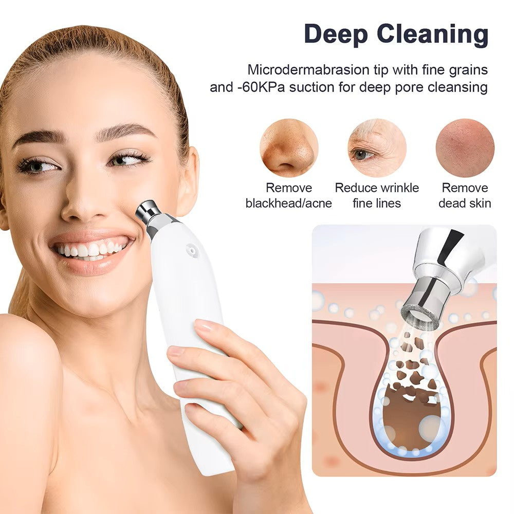 Máquina portátil de microdermoabrasión de diamante para peeling facial - Limpiador profundo de poros y extractor de espinillas al vacío - Para exfoliación y rejuvenecimiento de la piel