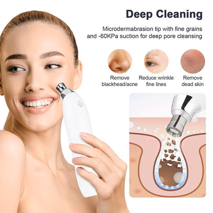 Máquina portátil de microdermoabrasión de diamante para peeling facial - Limpiador profundo de poros y extractor de espinillas al vacío - Para exfoliación y rejuvenecimiento de la piel