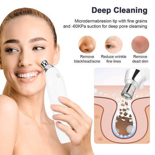 Máquina portátil de microdermoabrasión de diamante para peeling facial - Limpiador profundo de poros y extractor de espinillas al vacío - Para exfoliación y rejuvenecimiento de la piel