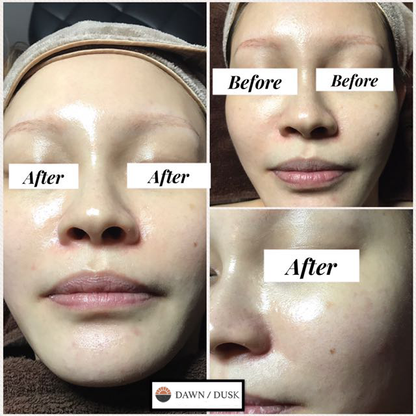 Cell Fusion C Tox Peel Serum - Anti-Aging Resurfacing Treatment